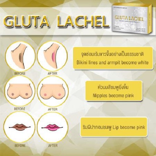 30 CAPS GLUTA LACHEL (LAPUNZEL) FOR SUPER AURA WHITENING SKIN ACNE SCARS REDUCE DARK SPOT by www.ccthaitown.com