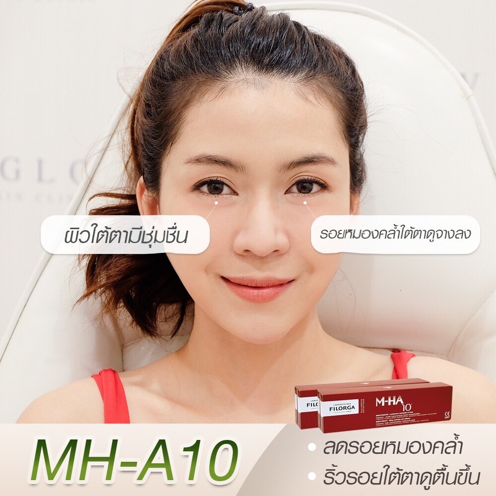 FILORGA M-HA10 PURE HYALURONIC ACID MESOTHERAPY by "www.ccthaitown.com"