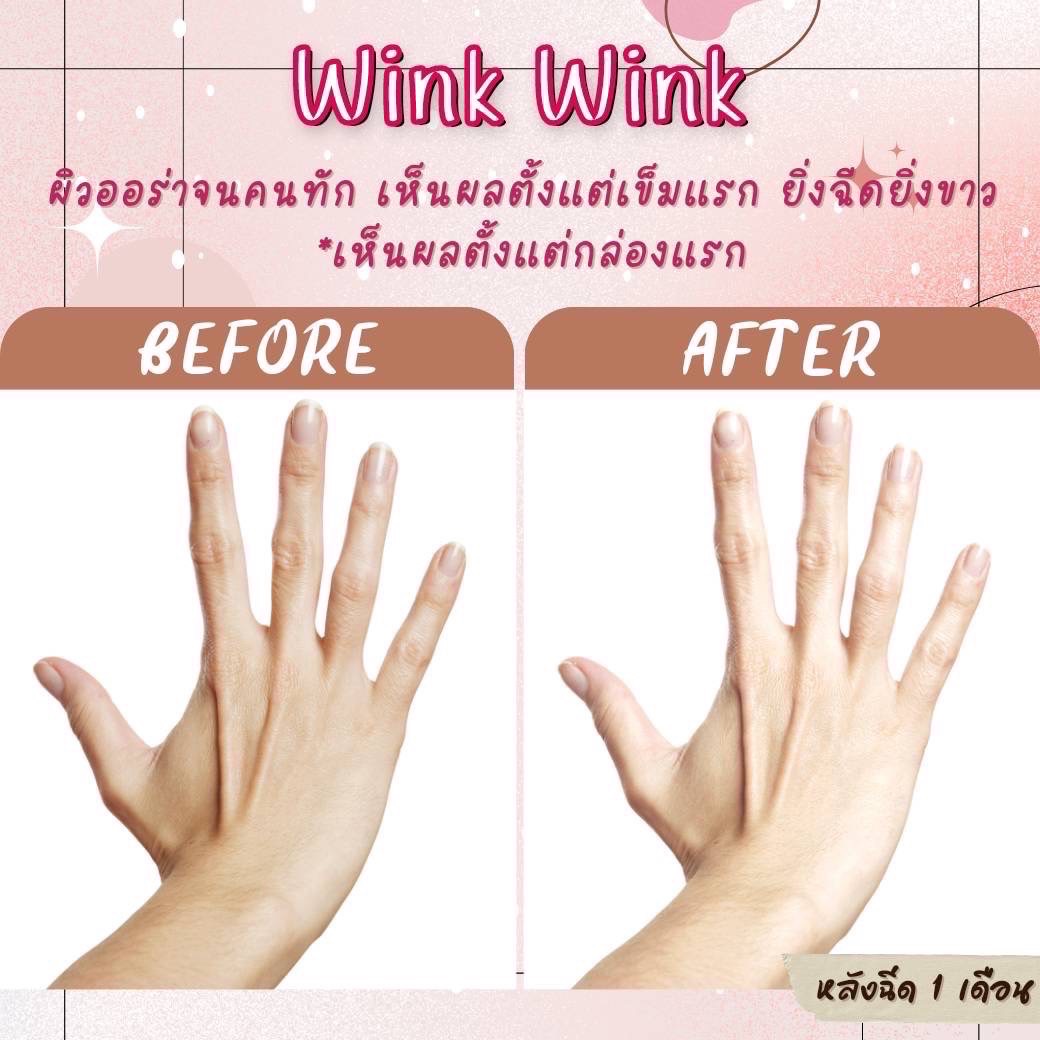 WINK WINK GLUTATHIONE 33000000 MG INJECTION