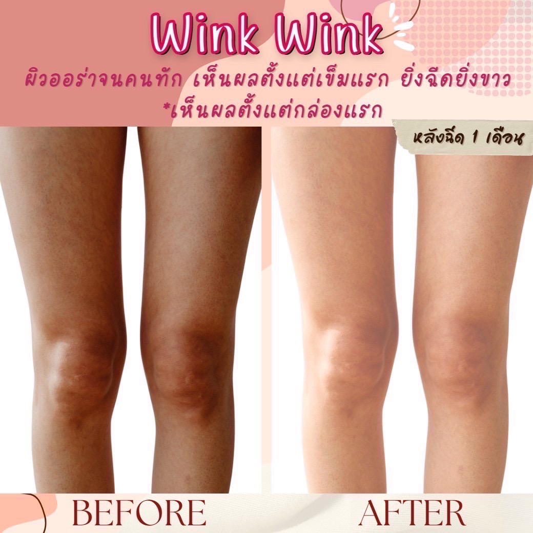 WINK WINK GLUTATHIONE 33000000 MG INJECTION