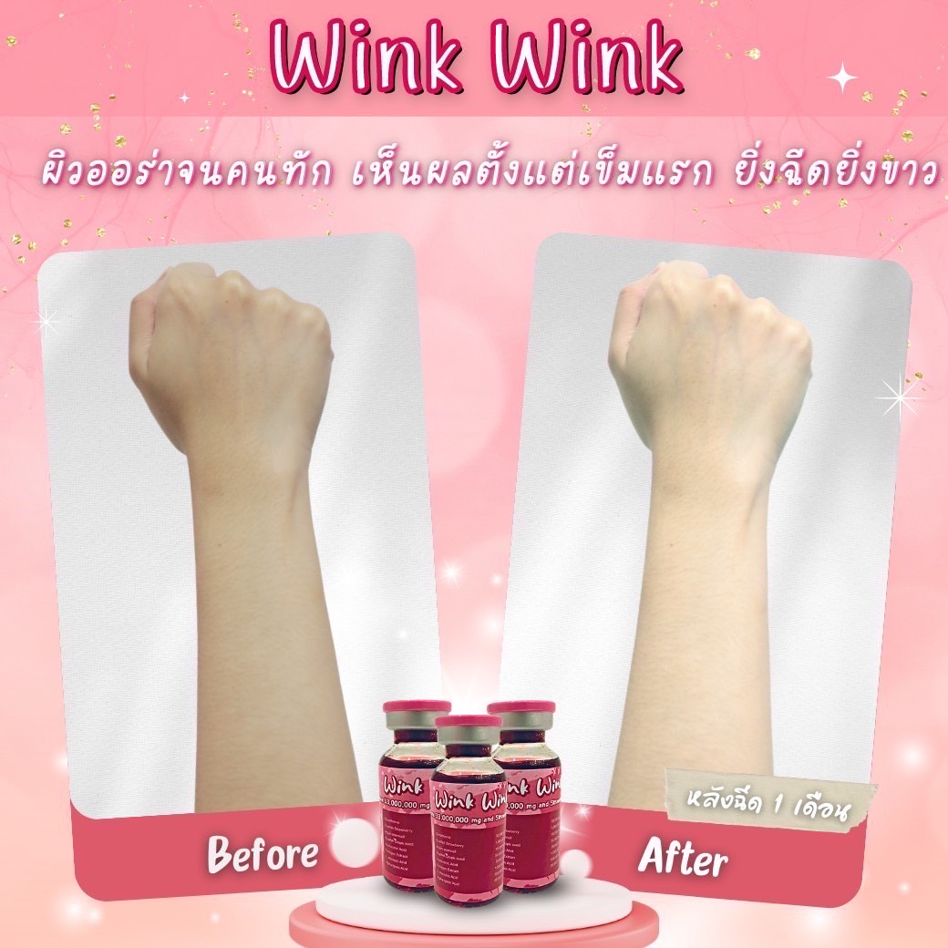 WINK WINK GLUTATHIONE 33000000 MG INJECTION