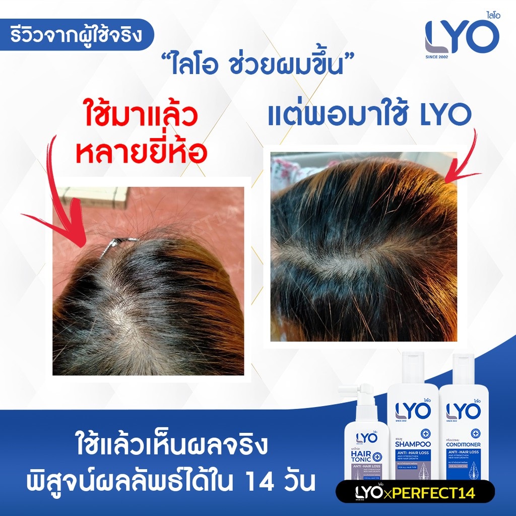 30 ML HAIR TONIC (ANTI-HAIR LOSS) LYO BRAND