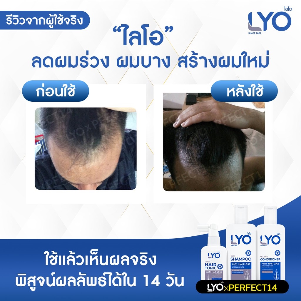 30 ML HAIR TONIC (ANTI-HAIR LOSS) LYO BRAND