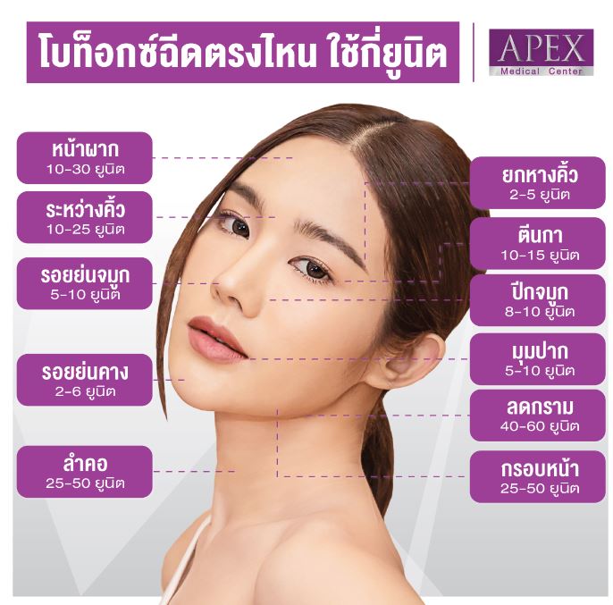 WONDERTOX 100 UNITS (KOREA) (BOTOX)